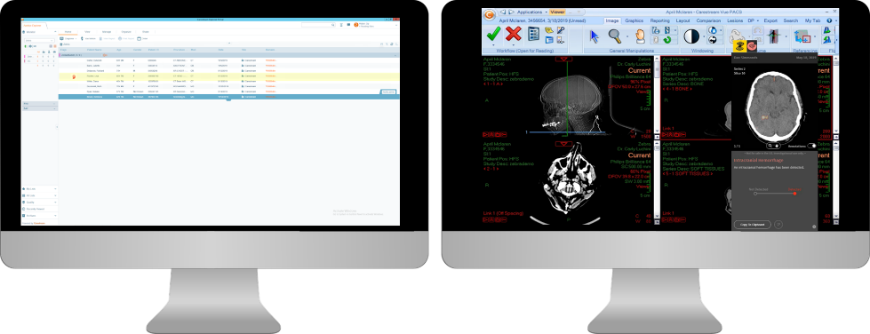 Making Ai Accessible To Radiologists Via Native Workflows What S Next